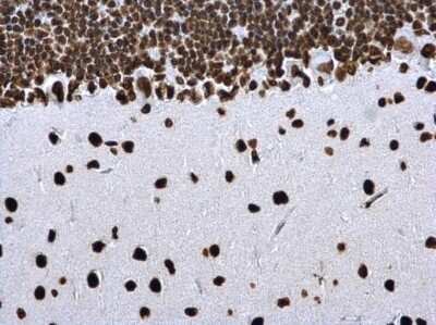 Immunohistochemistry-Paraffin: Histone H4 [ac Lys8] Antibody [NBP2-42863]